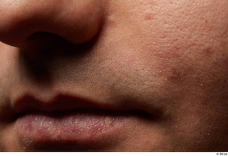 HD Face Skin Raymon Kastor face lips mouth nose skin…
